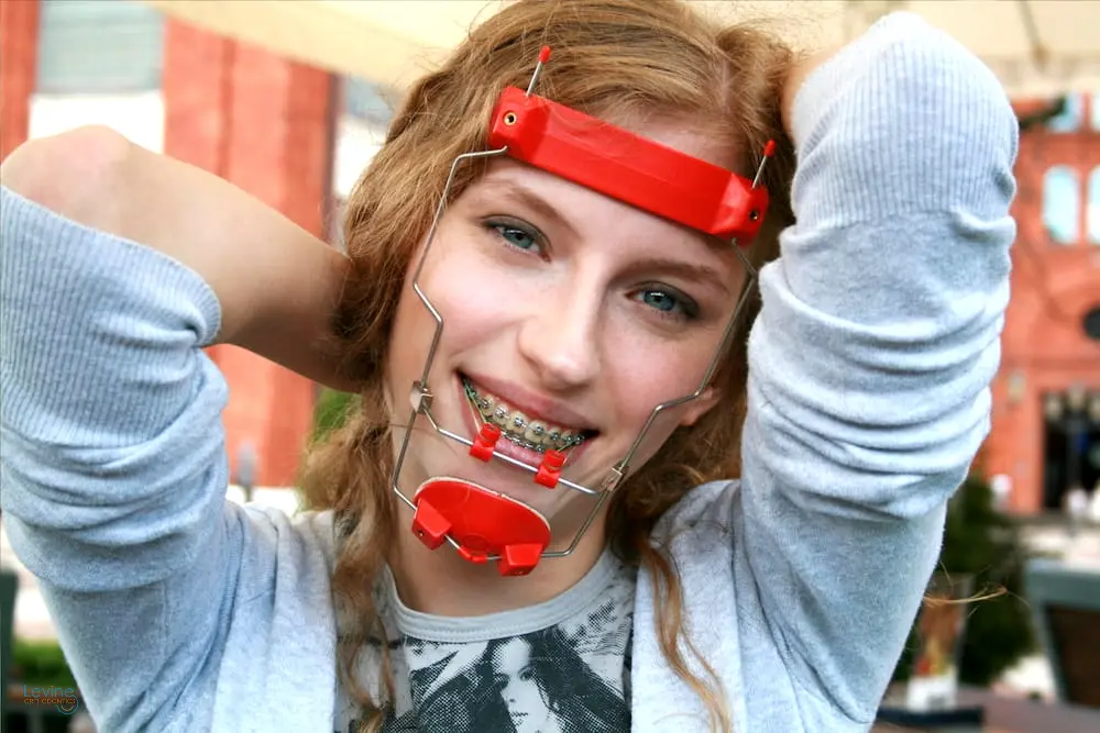 a woman smiling and posing at the camera while wearing a red pull reverse headgear with braces in Fort Myers & Cape Coral, FL