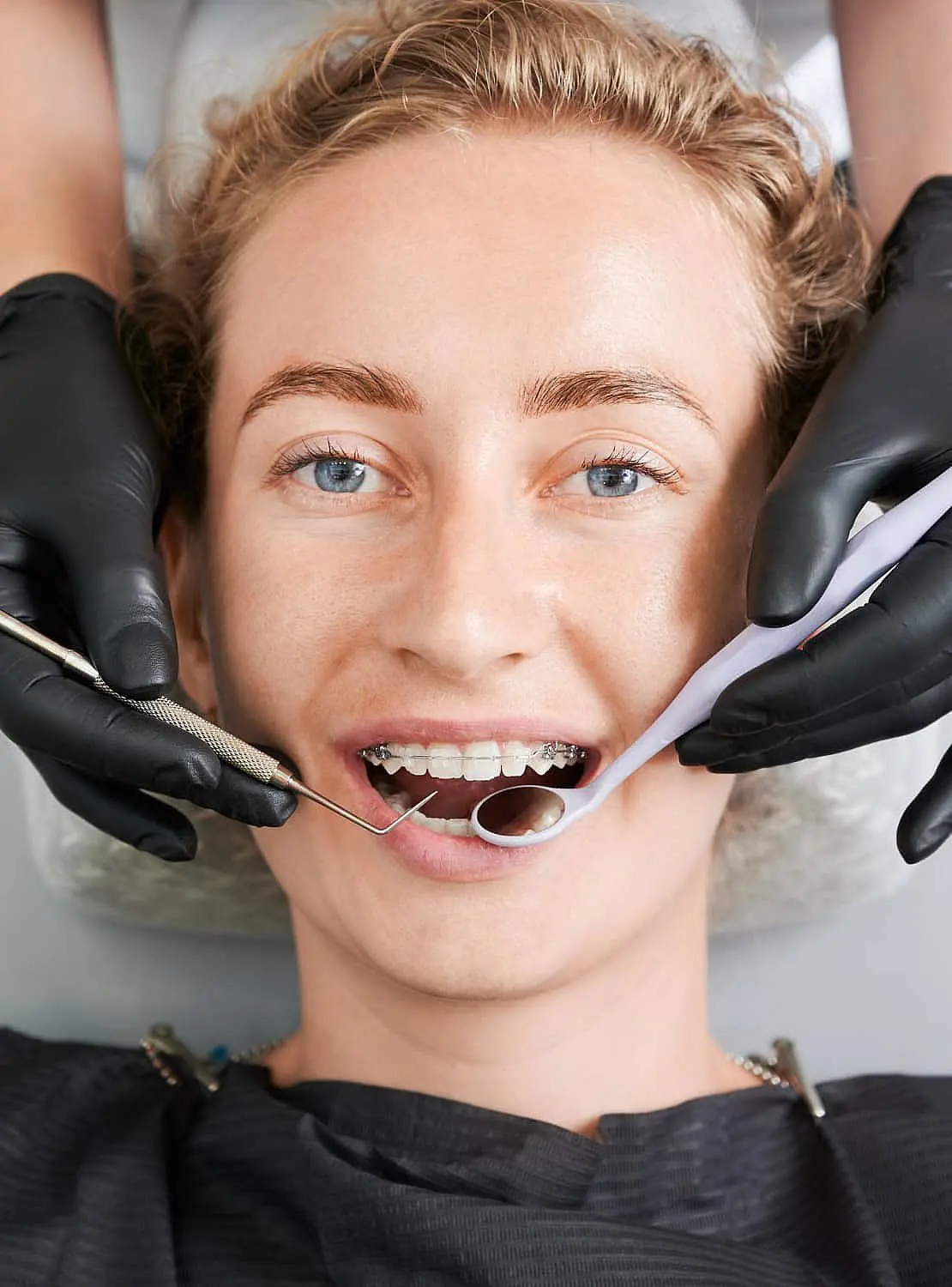 A professional in black gloves carefully examines a patient with clear ceramic braces at Levine Orthodontics in Cape Coral, FL.