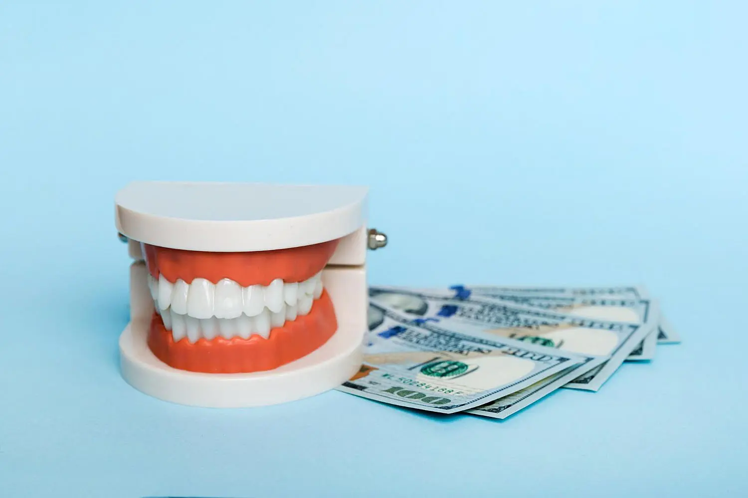 A dental model with clear braces is displayed alongside several $100 bills on a light blue background, representing Levine Orthodontics in Fort Myers, Cape Coral or Lehigh Acres, FL.