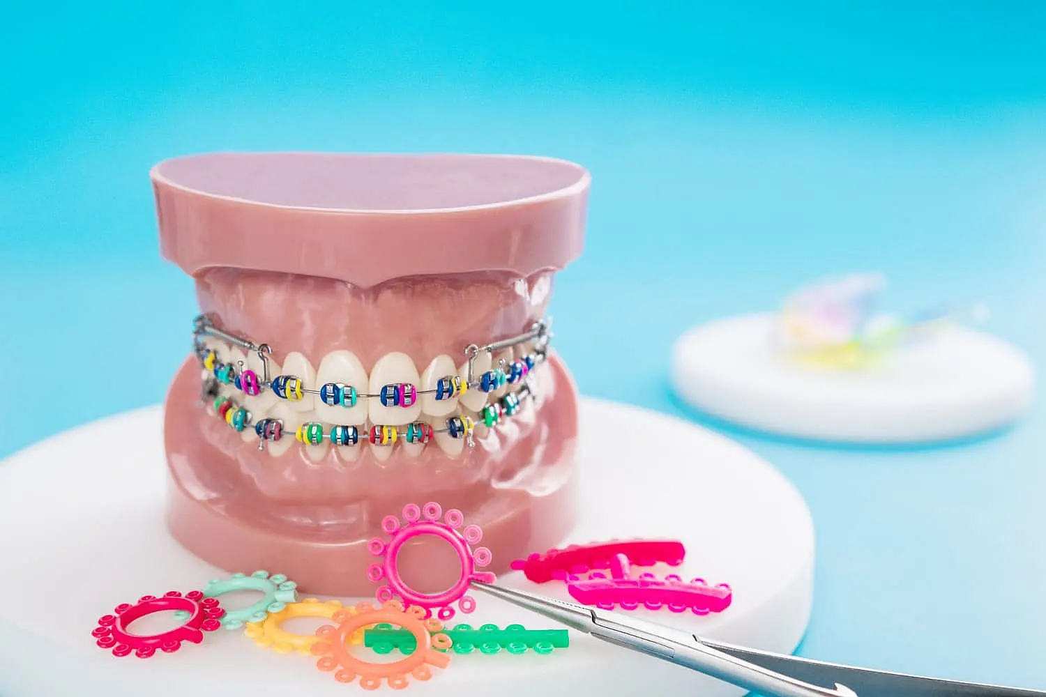 At Levine Orthodontics in Fort Myers, Cape Coral or Lehigh Acres, FL, a dental model featuring metal braces with colorful elastics is showcased on a white surface, accompanied by orthodontic tools and loose elastics.
