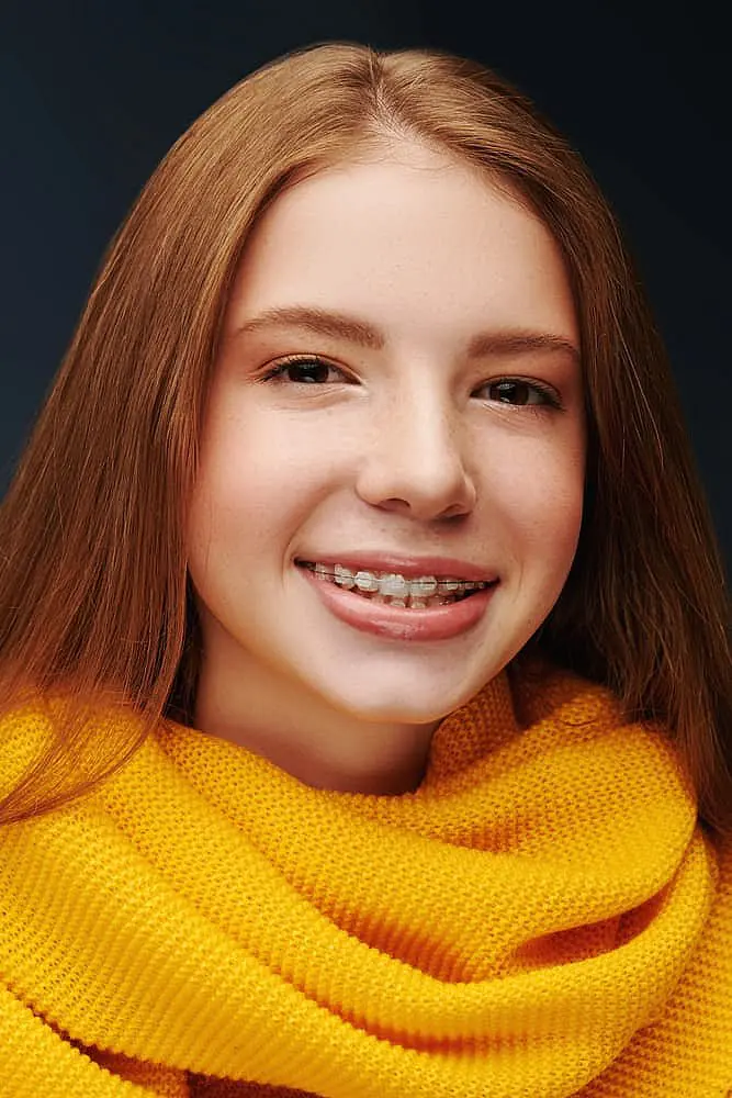 A young person with long straight hair and a yellow knit scarf smiles, showing clear ceramic braces from Levine Orthodontics in Fort Myers, FL.