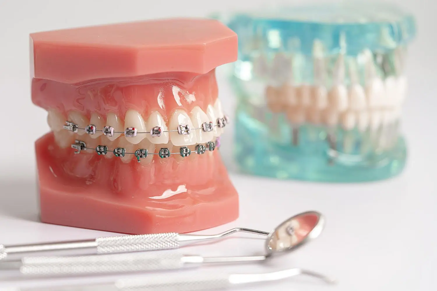 Displayed against a plain light background, this dental model showcases the structure and appearance of metal braces used in orthodontic treatment at Levine Orthodontics in Fort Myers, Cape Coral or Lehigh Acres, FL.