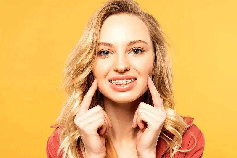 At Levine Orthodontics in Lehigh Acres, FL, a woman with long blonde hair smiles and points to her clear ceramic braces against a solid yellow background.