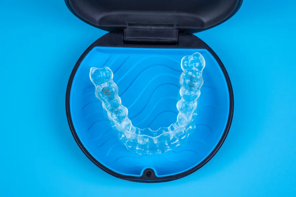 A clear Invisalign clear aligner from Levine Orthodontics is displayed in an open blue and black protective case on a blue background, representing personalized Invisalign treatment by Levine Orthodontics in Cape Coral, FL.