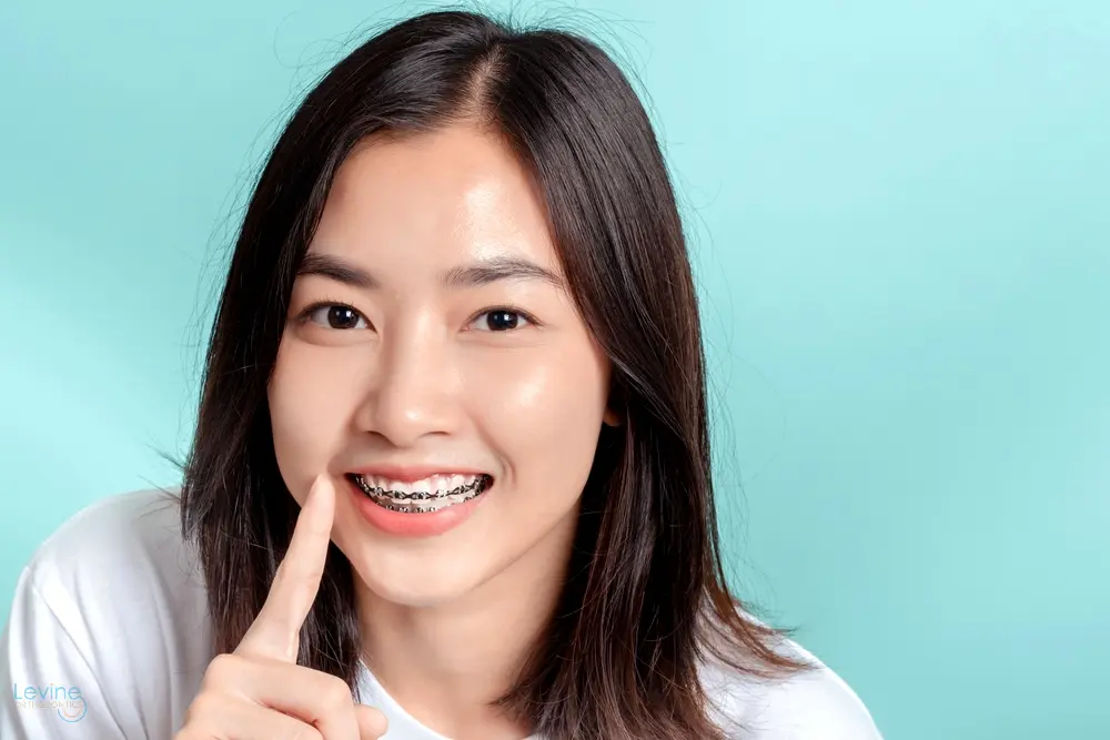 dental braces young asian woman wearing metal braces beauty smile - How to Get Braces Glue Off Teeth in Fort Myers, Cape Coral, and Lehigh Acres, FL