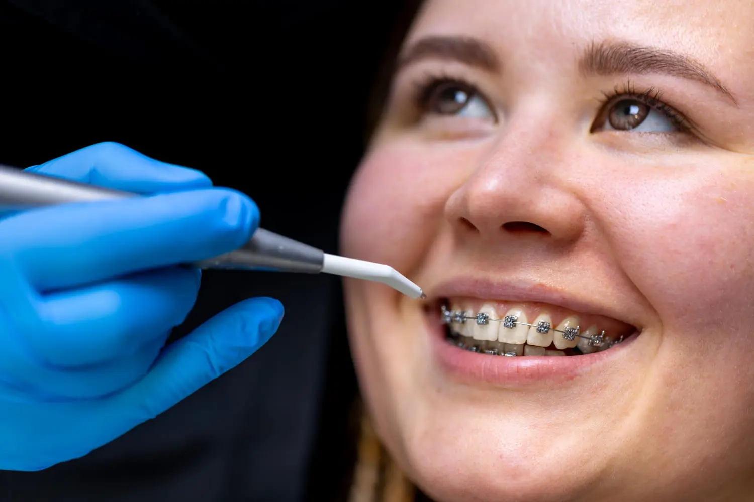 Smiling patient with braces at Levine Orthodontics in Fort Myers, FL, awaits possible braces removal.