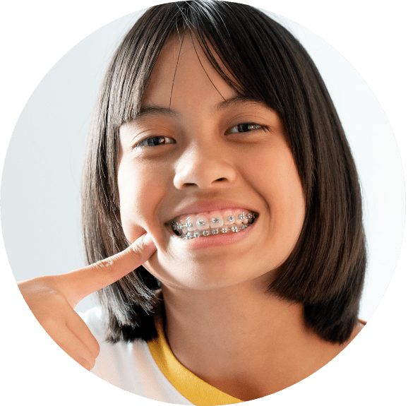 Clear Braces vs. Traditional Braces - Fort Lee Family Dental Fort